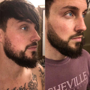 Ultra-Realistic Beard Kit for Instant Facial Hair Perfection